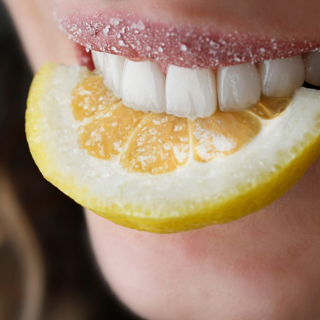 Diseño de Sonrisa Bogotá